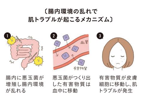 腸胃影響皮膚|皮膚科医に聞く！ 腸内環境とお肌の関係は？